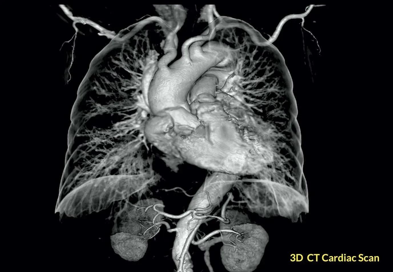 CT Angiography in Navi Mumbai