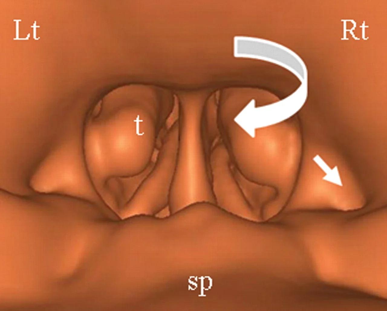 CT Endoscopy & Virtual Bronchoscopy in Navi Mumbai