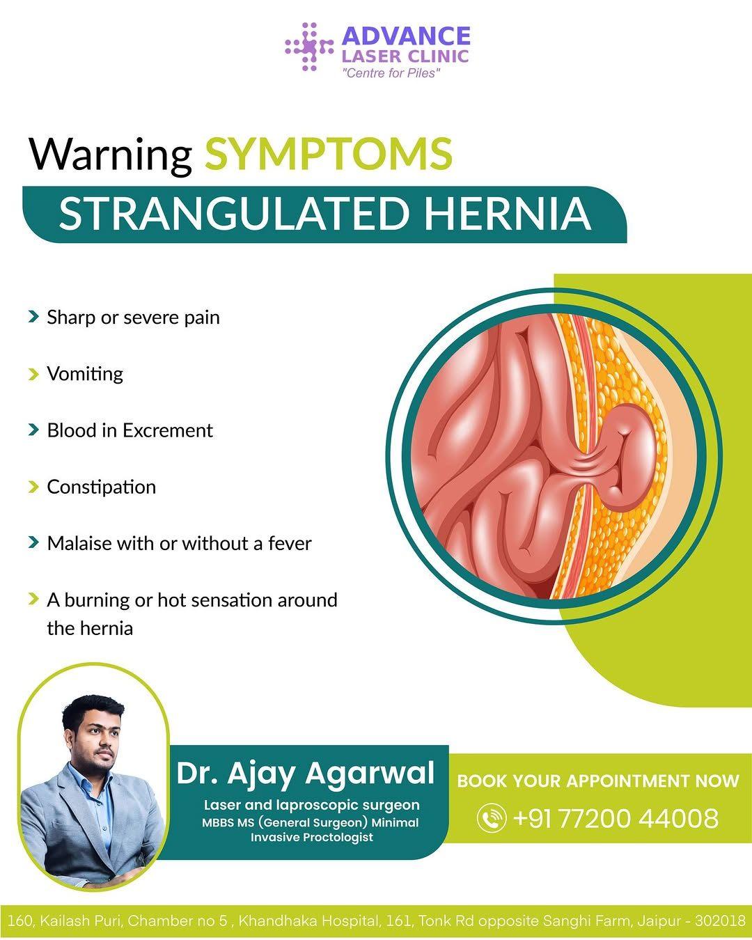 Hernia doctor in Jaipur