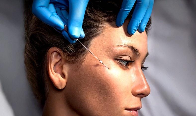 Thread Lift Certification & Cosmetic Nursing Diploma in Bangalore 