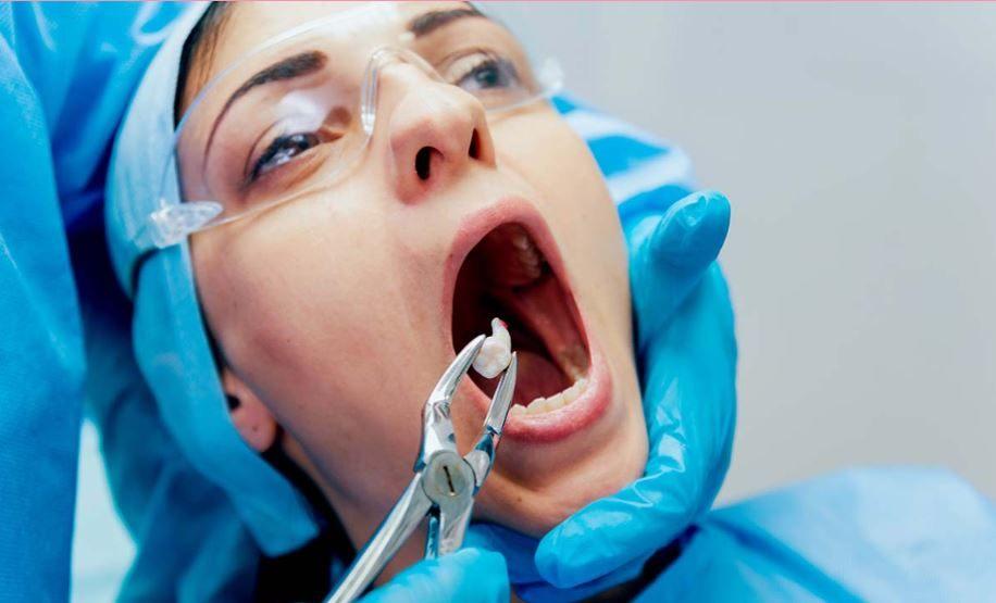Wisdom Tooth Removal in BTM Layout, Bangalore  - Perfect Dental Studio