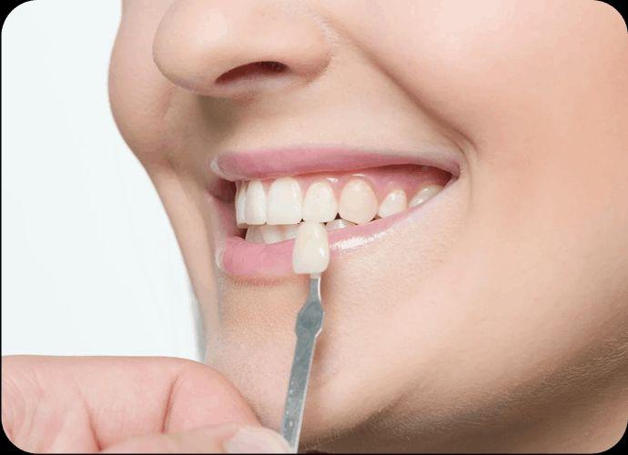 Transform Your Smile with The Smile Spa  Expert Smile Makeover Dental Clinic