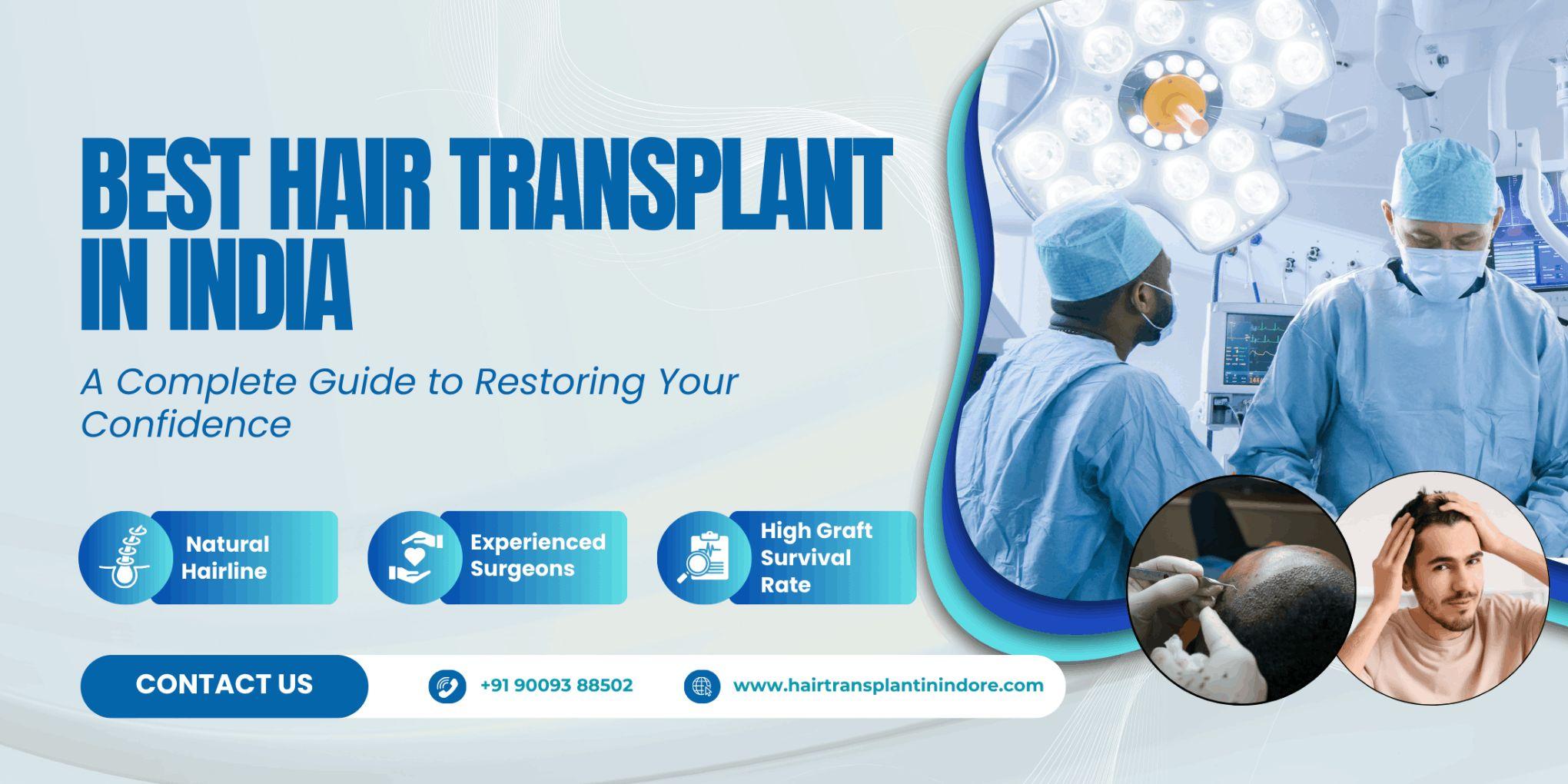 Best Hair Transplant in India: Top Clinics & Expert Care