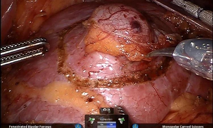 Laparoscopy Training in Gurugram