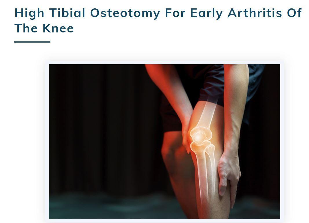 High Tibial Osteotomy for Early Arthritis of the Knee in Koramangala - Dr. Rewat