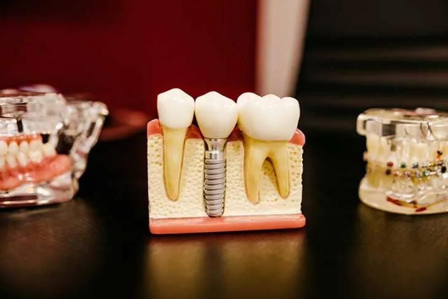Trusted Dental Experts in Gurgaon - Imperial Dental Implant Clinic (Gurgaon)