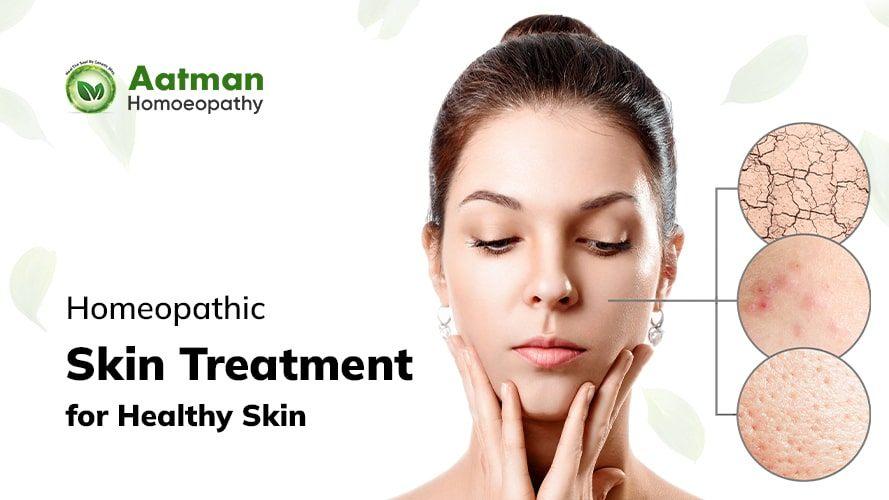 Homeopathic Skin Treatment for Healthy Skin