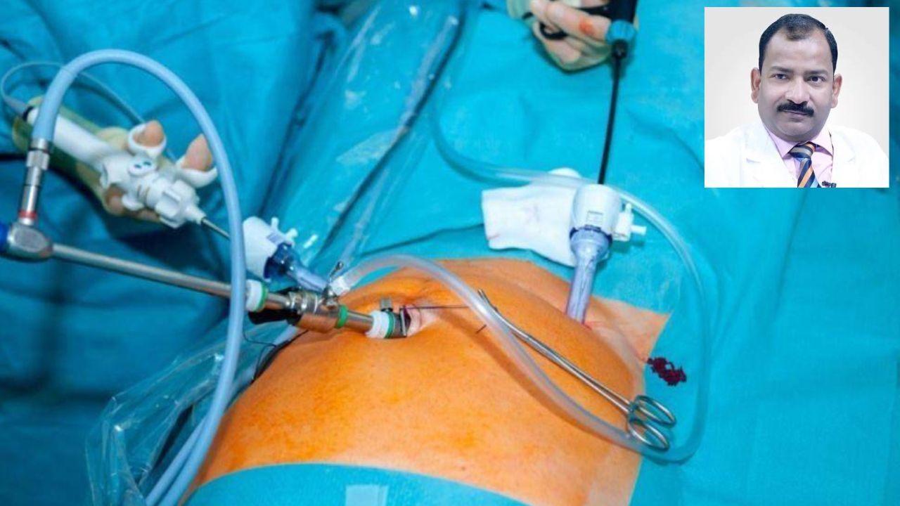 Laparoscopic Training in India