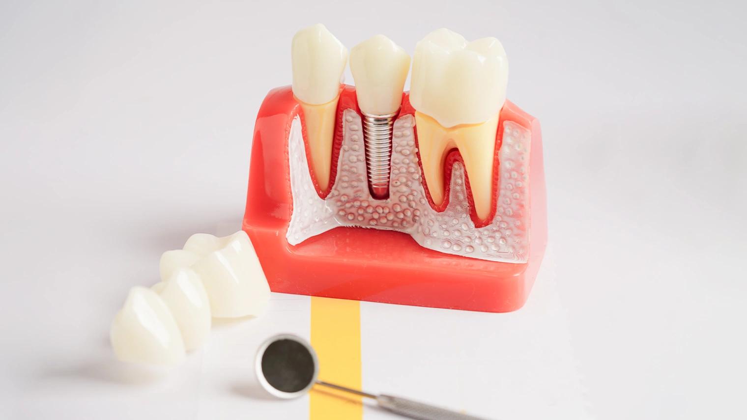 Pediatric Dental Care by Dr. Bobby Kochis Child-Friendly Dentist!