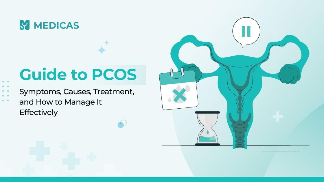 PCOS Explained: How to Identify, Treat, and Manage It Naturally