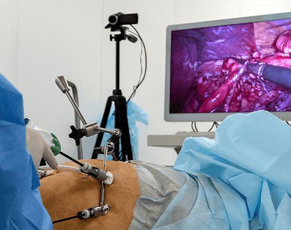 Minimally Invasive Surgery: Laparoscopic Training in India