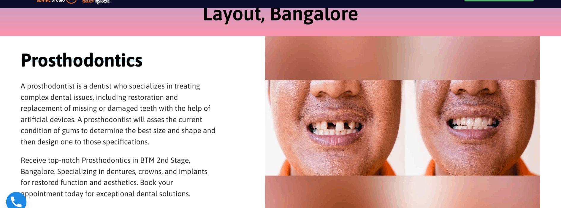 Prosthodontics in BTM  2nd Stage Bangalore - Perfect Dental Studio