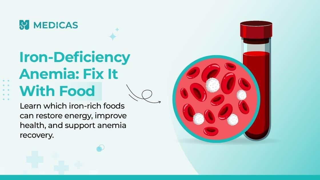 Top Dietary Tips to Fight Iron-Deficiency Anemia Naturally