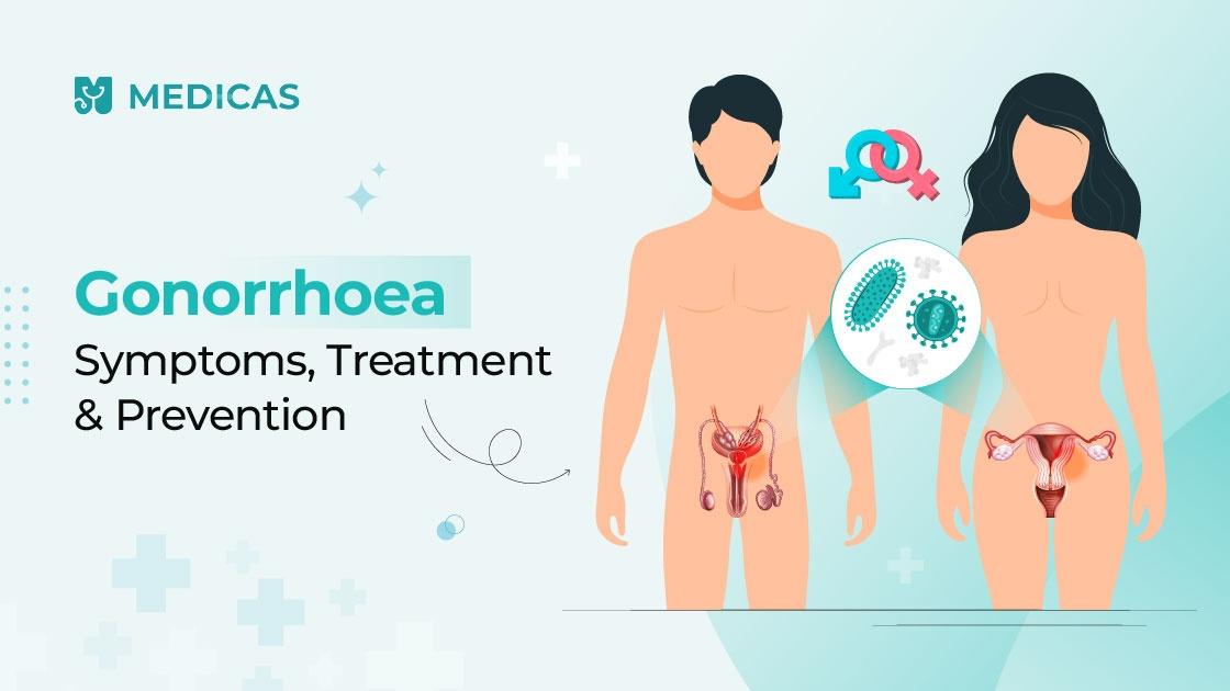 What is Gonorrhea? Know the Signs, Treatment, and Prevention