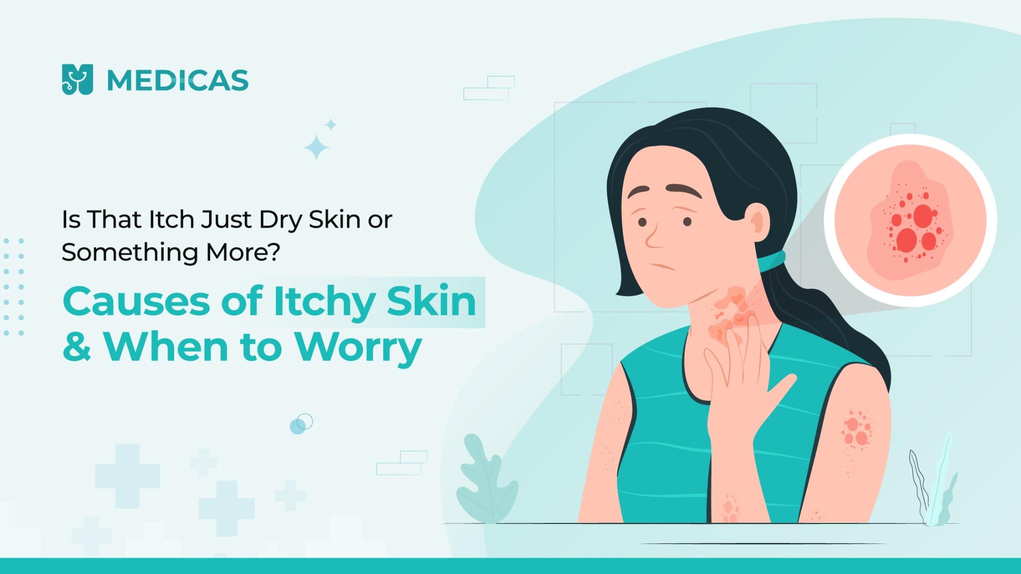 Itchy Skin Causes: Common Triggers and When to Seek Help