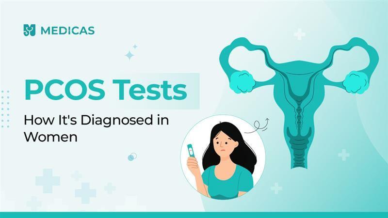 PCOS Testing Guide: Blood Work, Ultrasounds, and More