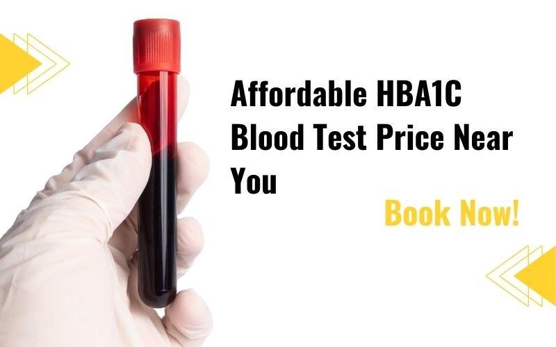 HbA1c Blood Test: Purpose, Normal Range & Price Details