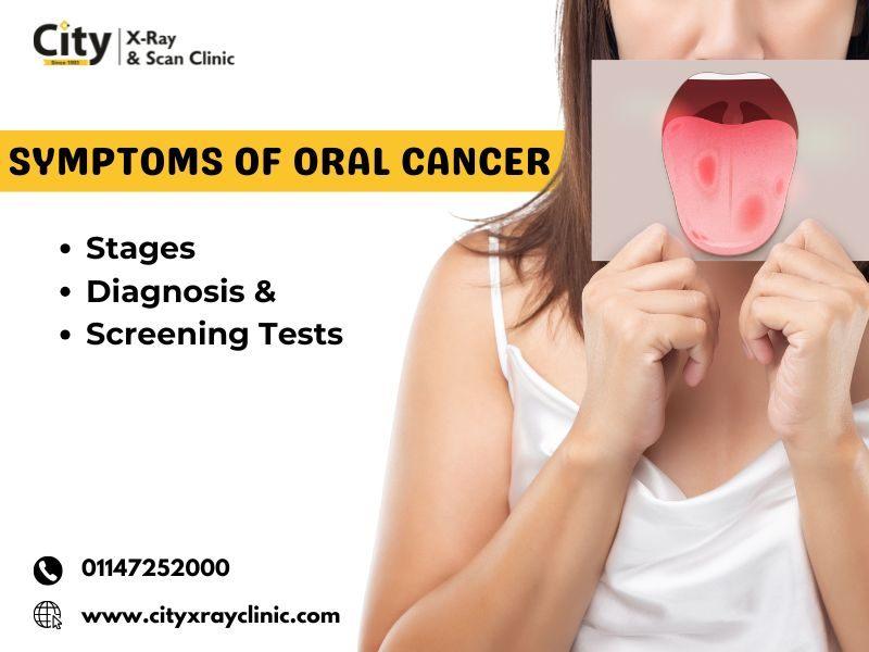 Symptoms of Oral Cancer: Stages, Diagnosis & Screening Tests