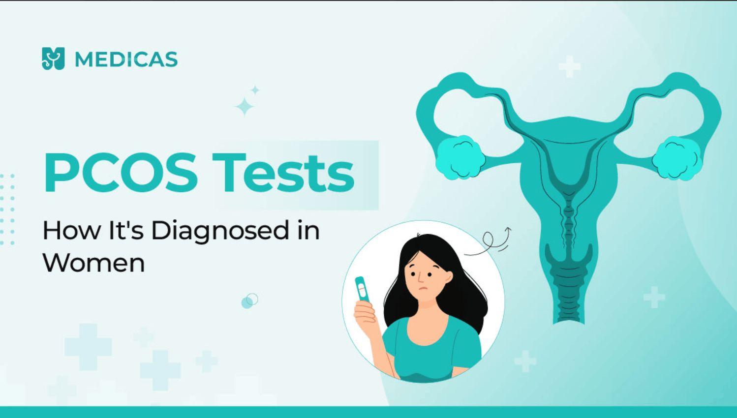 From Blood Tests to Ultrasound: How PCOS Is Detected