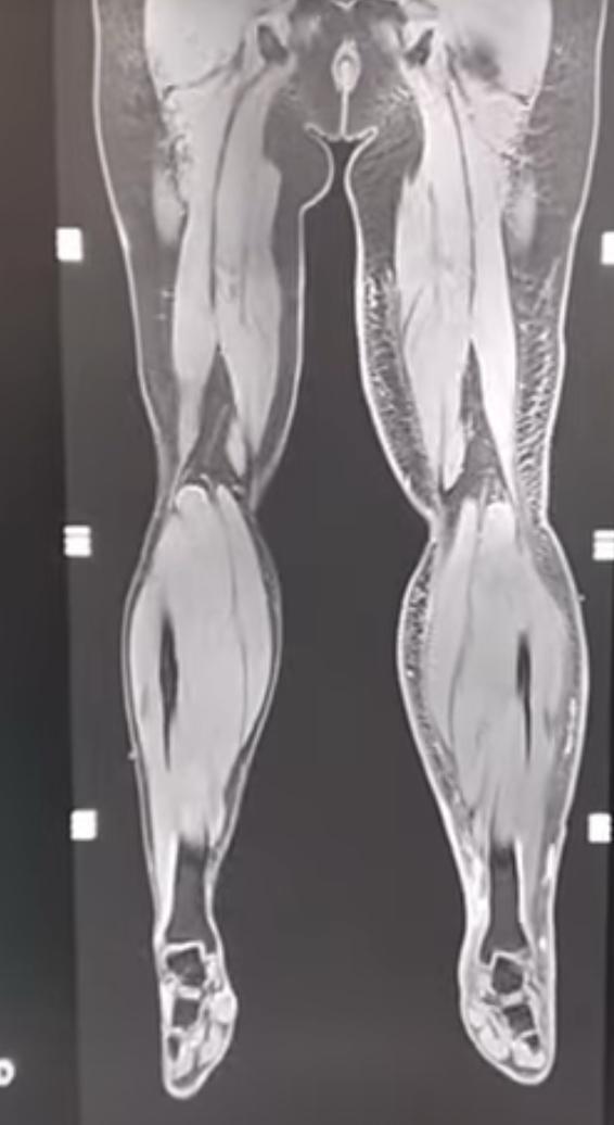 MRI Scan in Nagpur Maharashtra