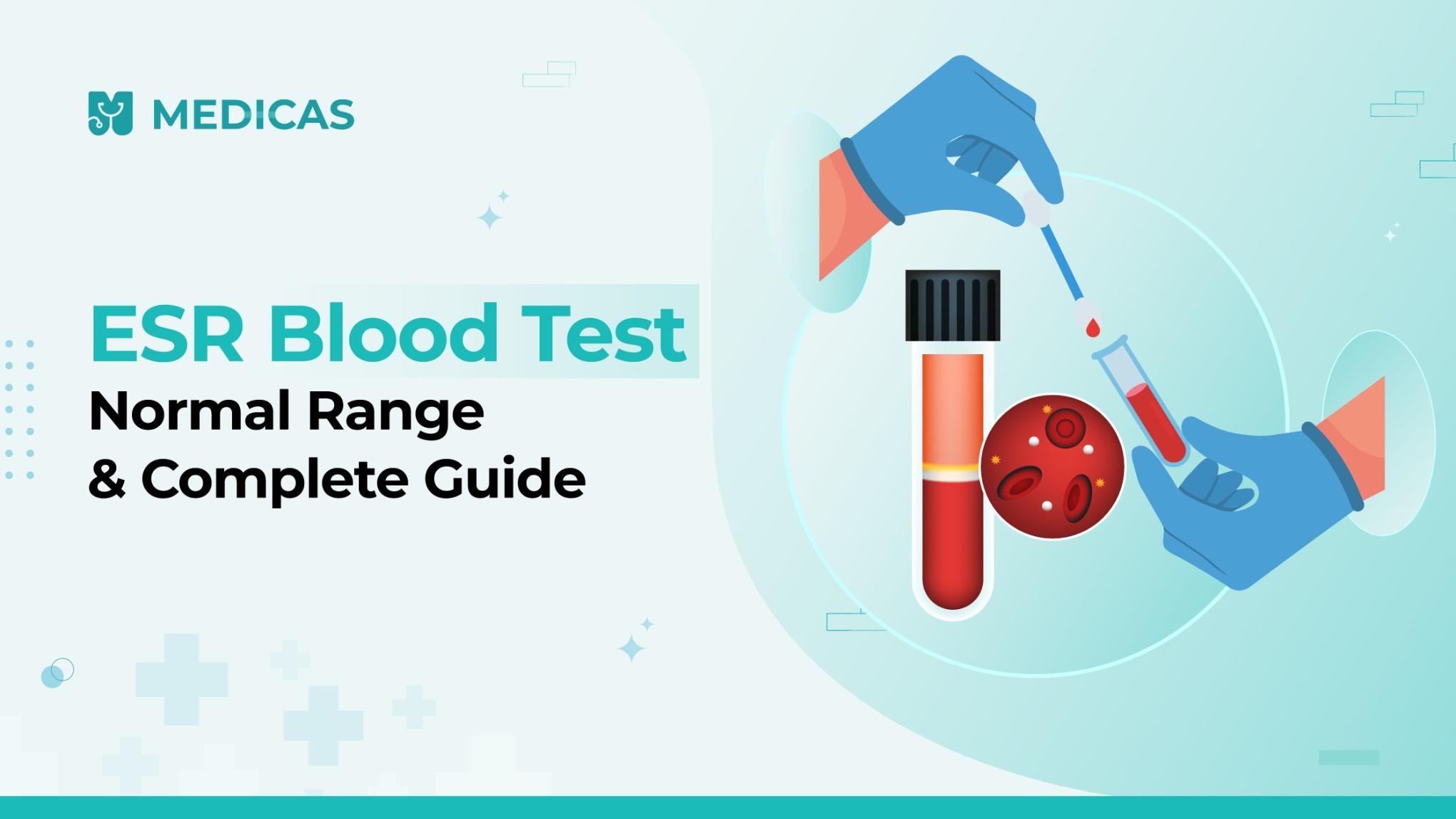 Understanding ESR Blood Test Normal Range by Age and Gender
