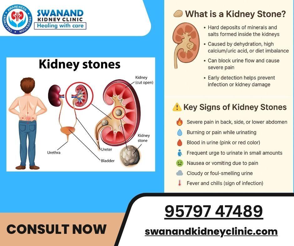 When Pain Isn't Just Pain It Could Be Kidney Stones