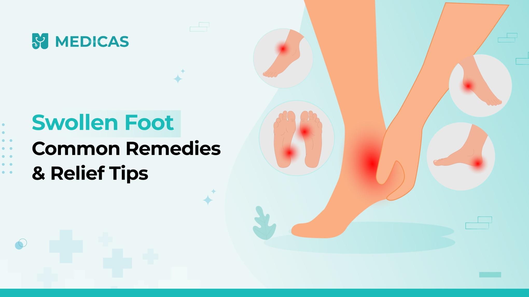 How to Reduce Foot Swelling: Best Home and Medical Remedies