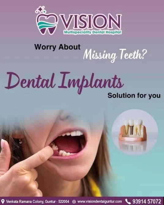 Affordable Dental Implants in Guntur  Restore Your Smile at Vision Dental clinic