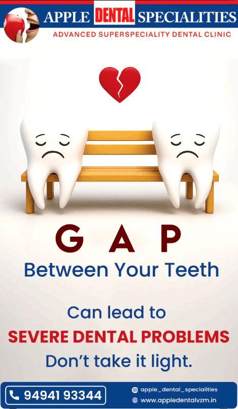 Mind the Gap Don t Ignore Spaces Between Your Teeth