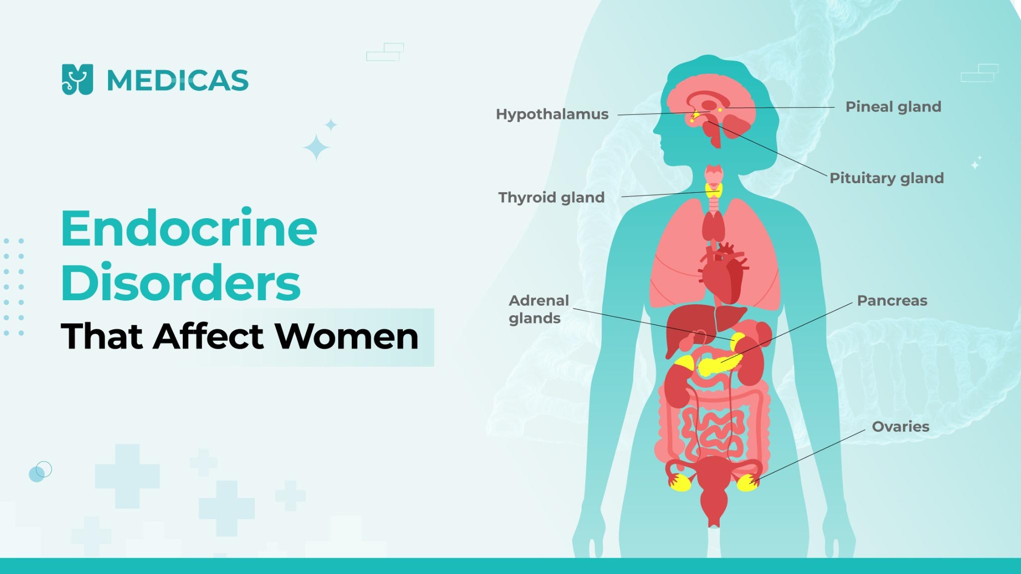 Endocrine Disorders in Women: Symptoms, Causes, and Treatments