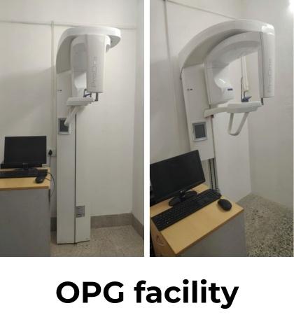 Dental Implants in Coimbatore