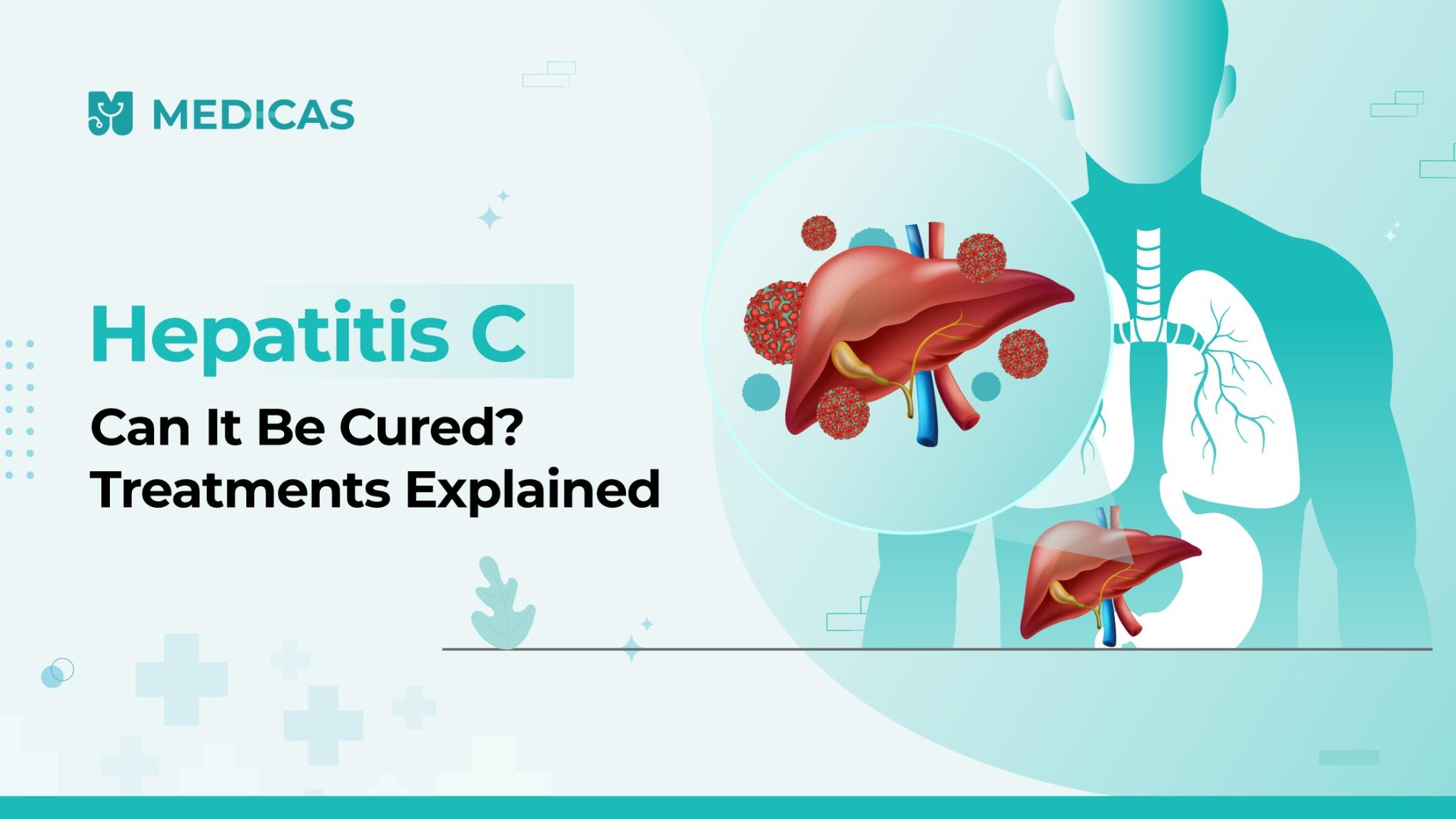 Is Hepatitis C Curable? Latest Medical Advances Explained