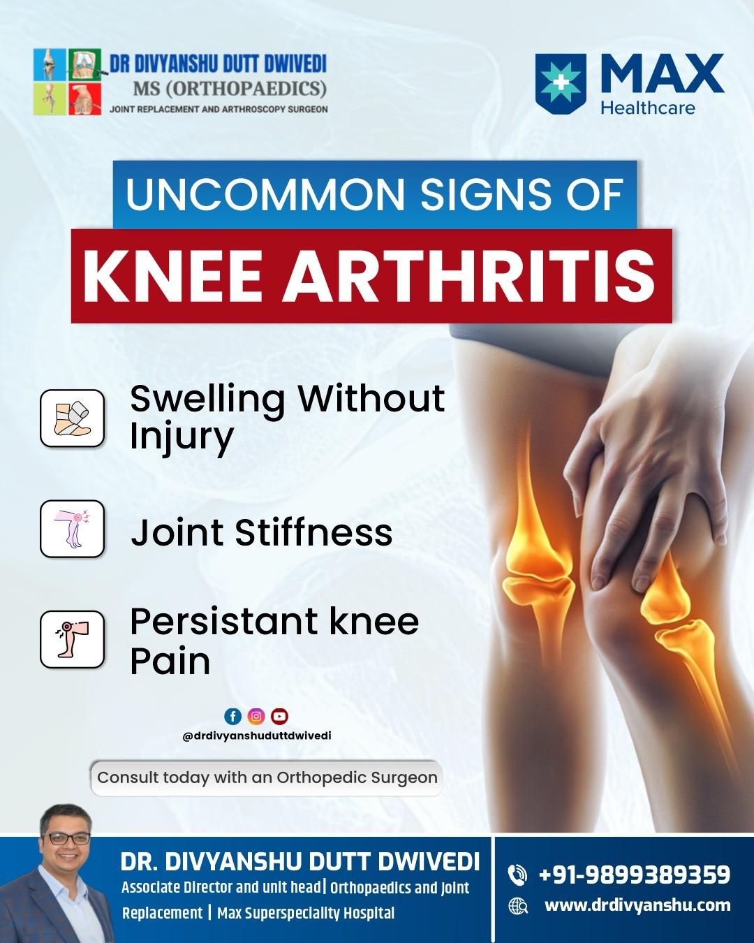 Consult Dr. Divyanshu Dutt Dwivedi Expert Arthroscopy Surgeon in Lucknow