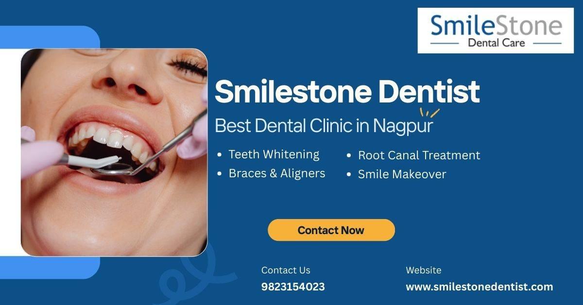 Best Orthodontist in Nagpur | Best Dentist in Nagpur 