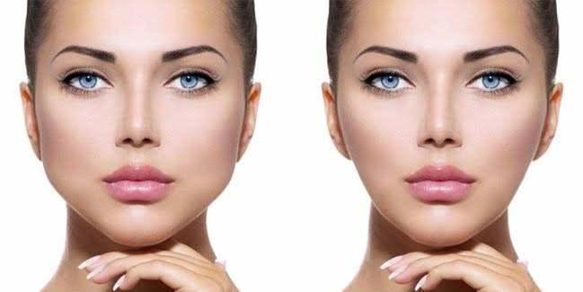 Best Buccal Fat Removal Clinics in Delhi 