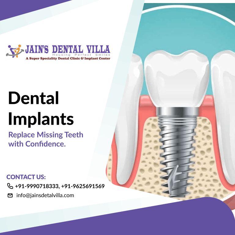 Dental Implant Clinic in Ashok Vihar for Expert Implant Treatment