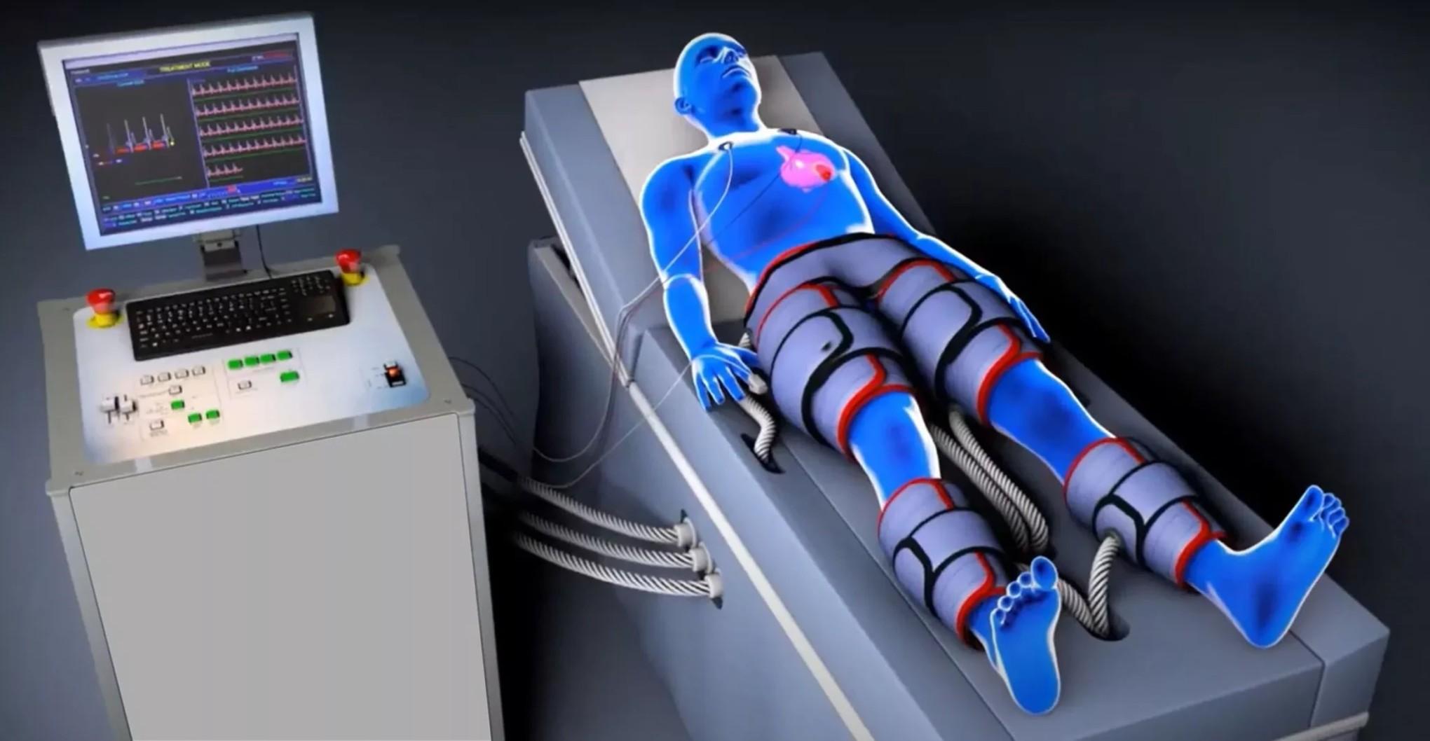 Non-Surgical Heart Treatment in Pune EECP Therapy Guide.