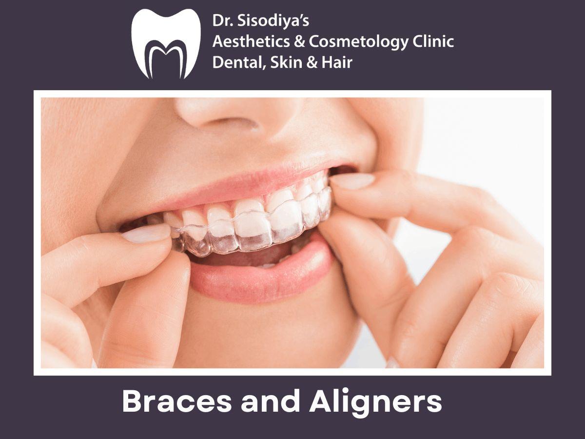 Braces and Aligners Treatment