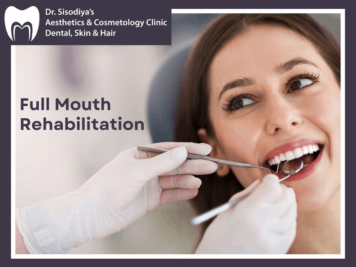 Full Mouth Rehabilitation