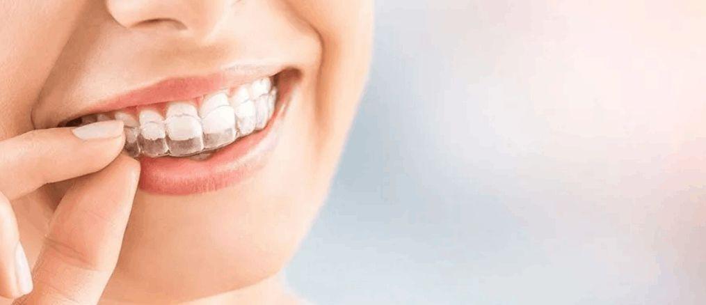 Invisible Braces Cost in Gurgaon | Advanced Orthodontic Care