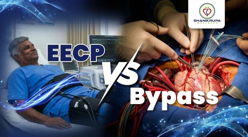 EECP vs Bypass Surgery: A Safer Non-Surgical Heart Care Path