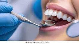 Dental Implants In Coimbatore 