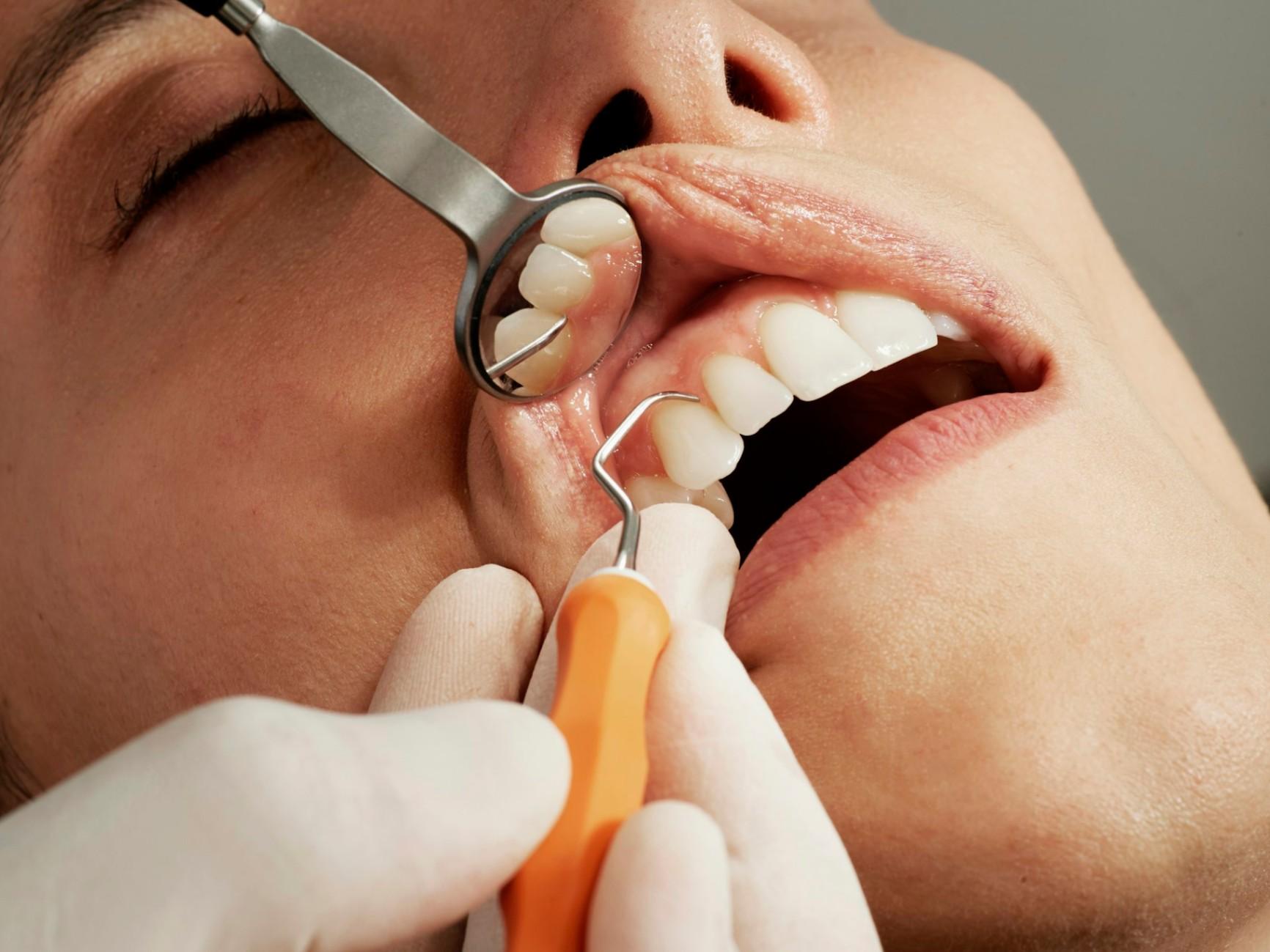 Painless Root Canal Treatment in Gorakhpur: Everything You Need to Know
