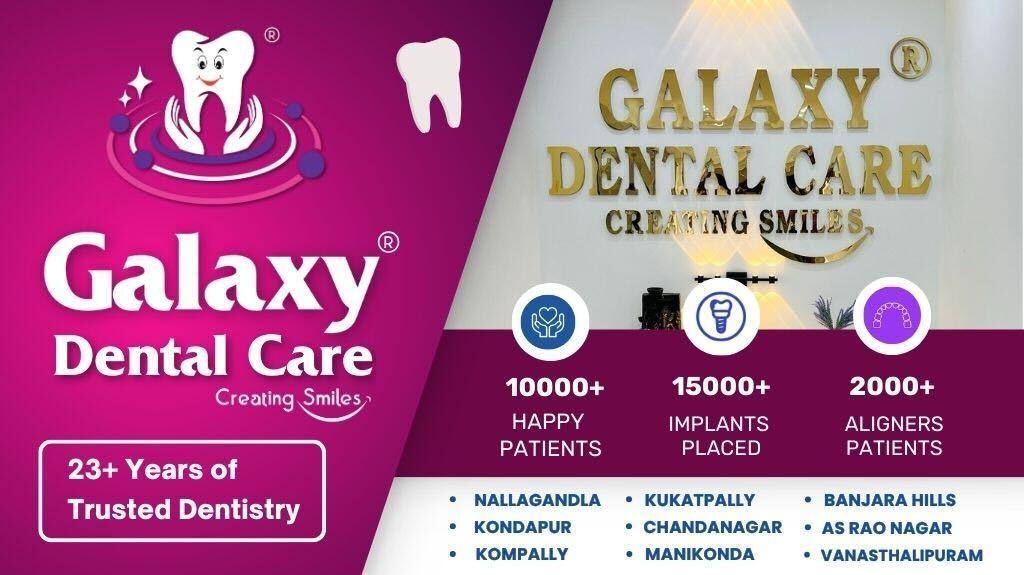 Galaxy Dental Care | Best Dental Clinic In Banjara Hills
