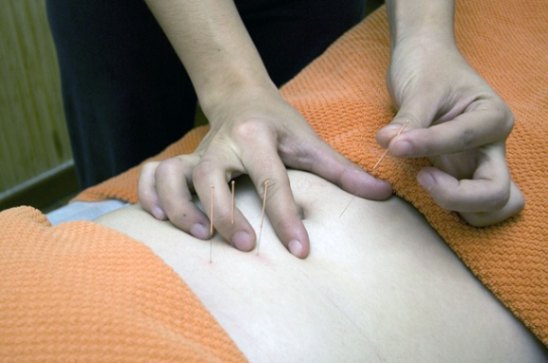Acupressure Therapy, Acupuncture Therapy, Ayurvedic; Exp: More than 5 year