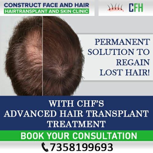 Hair Transplant, Hair/ Skin care
