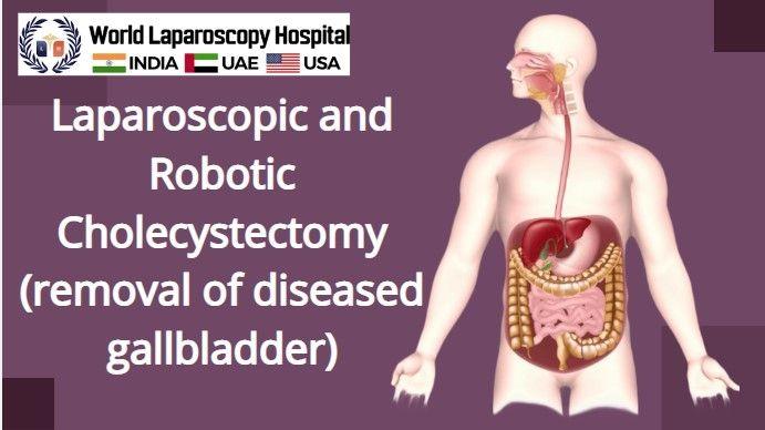 Laparoscopic and Robotic Cholecystectomy