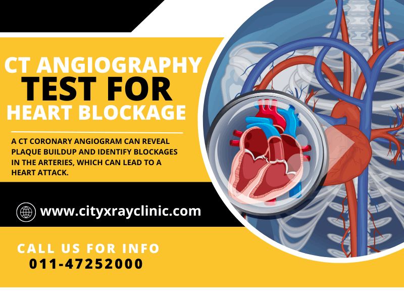 CT Coronary Scan services Near Me In Delhi At Low Price 