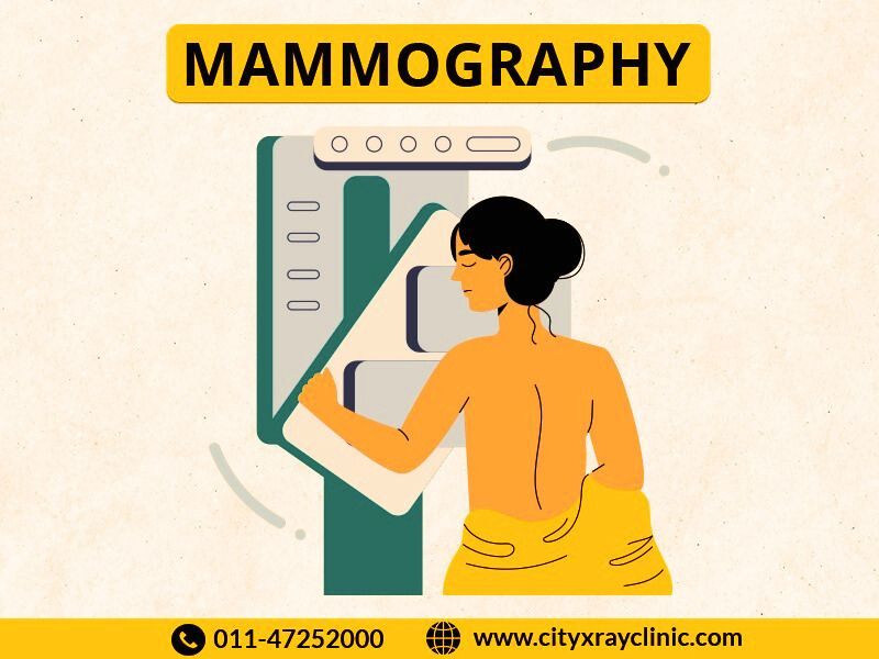 Mammography Scan Near Me In Delhi At Affordable Price 
