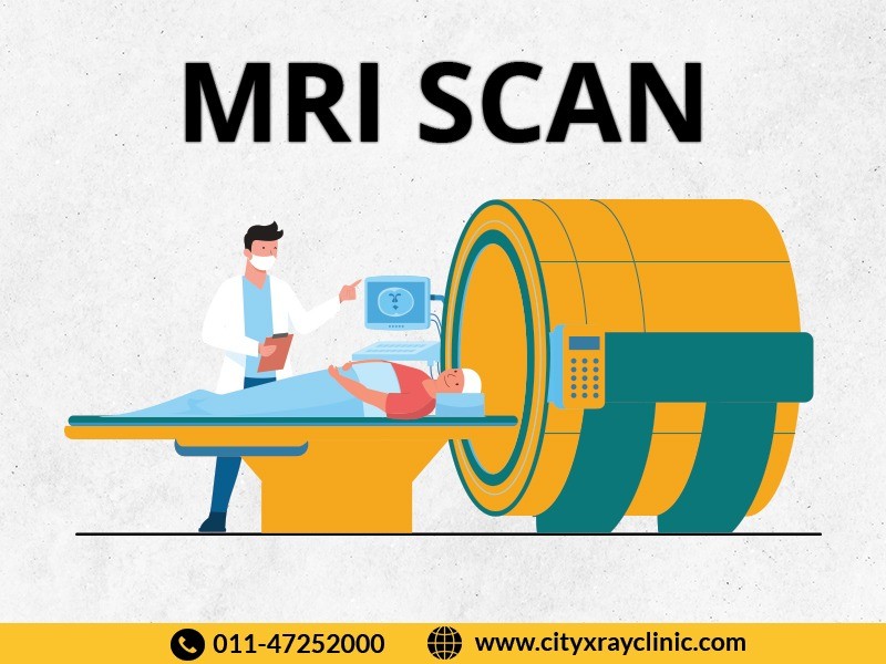 MRI Scan Near Me In Delhi At Affordable Price 